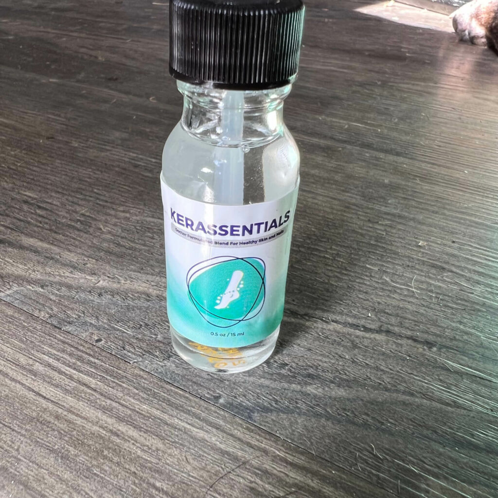 What is Kerassentials