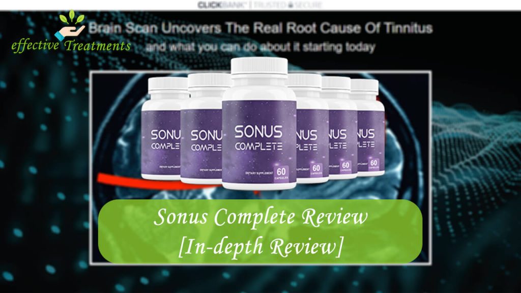 sonus complete review