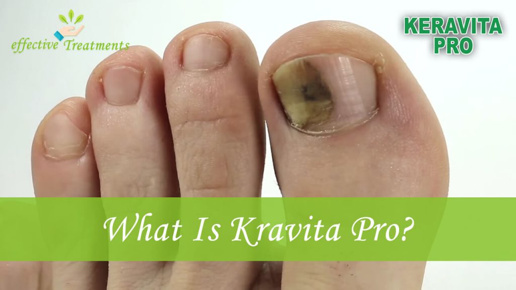 What is keravita pro?