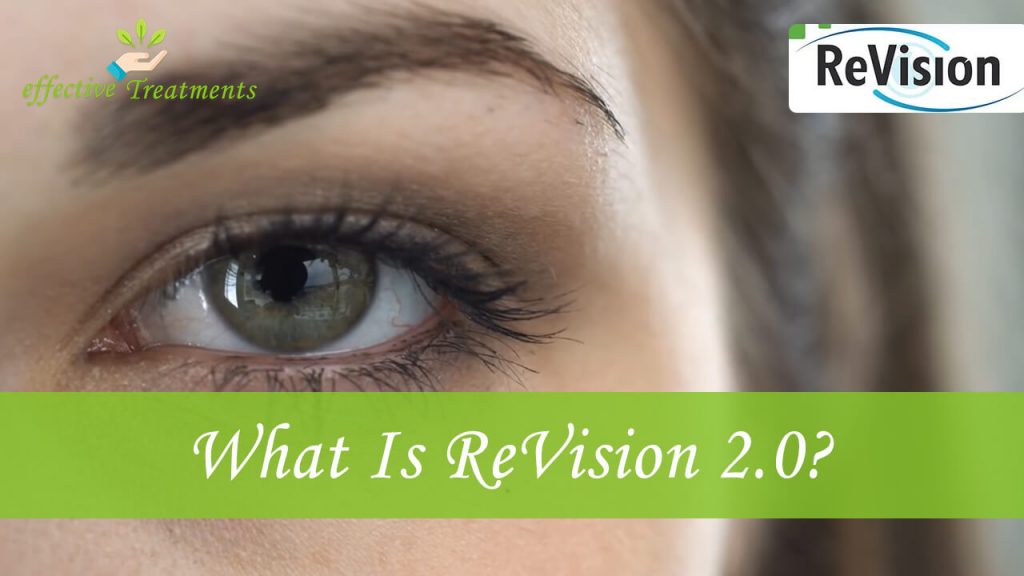 What is revision20 us
