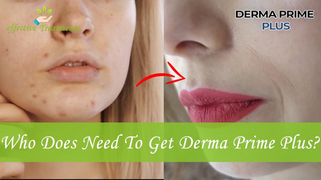 Who Does Need To Get Derma Prime Plus For Better Skin