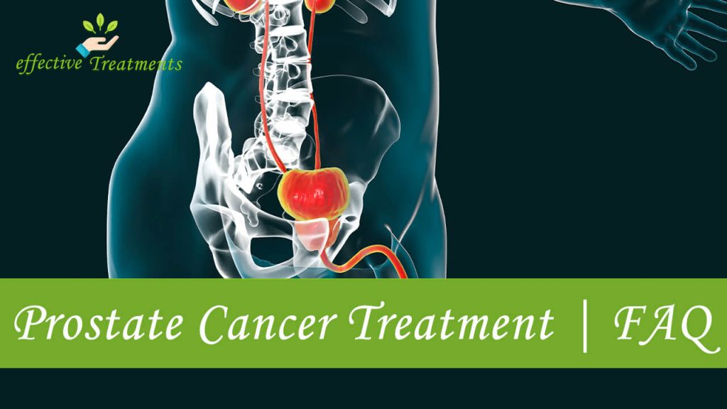 Prostate Cancer Treatment FAQ