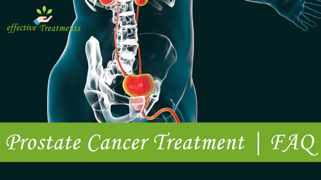 Prostate Cancer Treatment FAQ