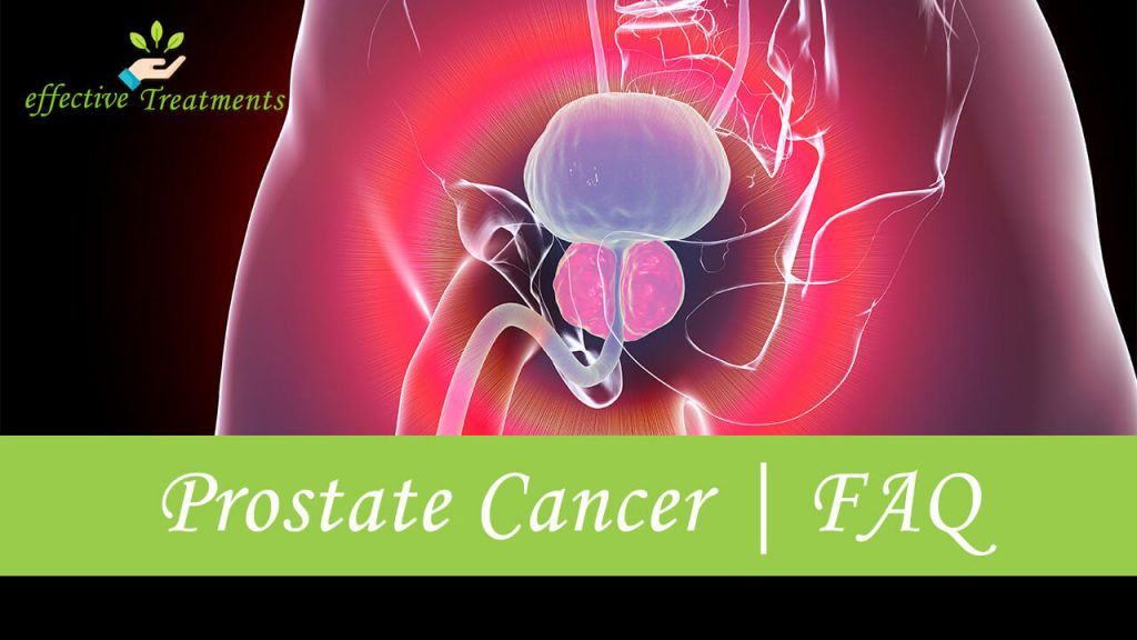 prostate cancer faq
