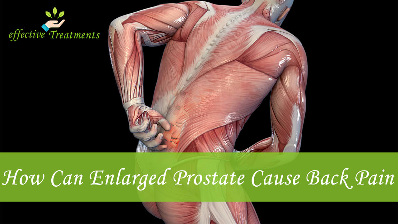 Prostate Infections And Back Pain [The Relation And Cures]