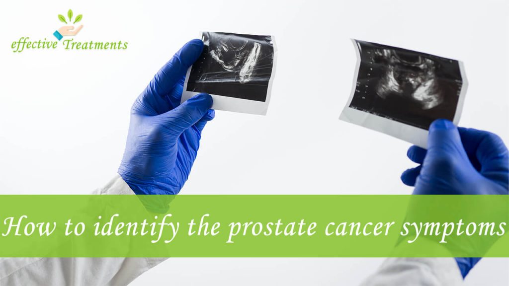 How to identify the prostate cancer symptoms