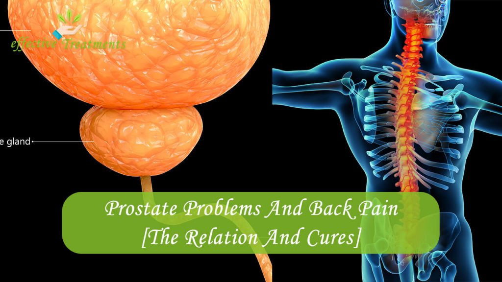 Prostate Problems And Back Pain The Relation And Cures