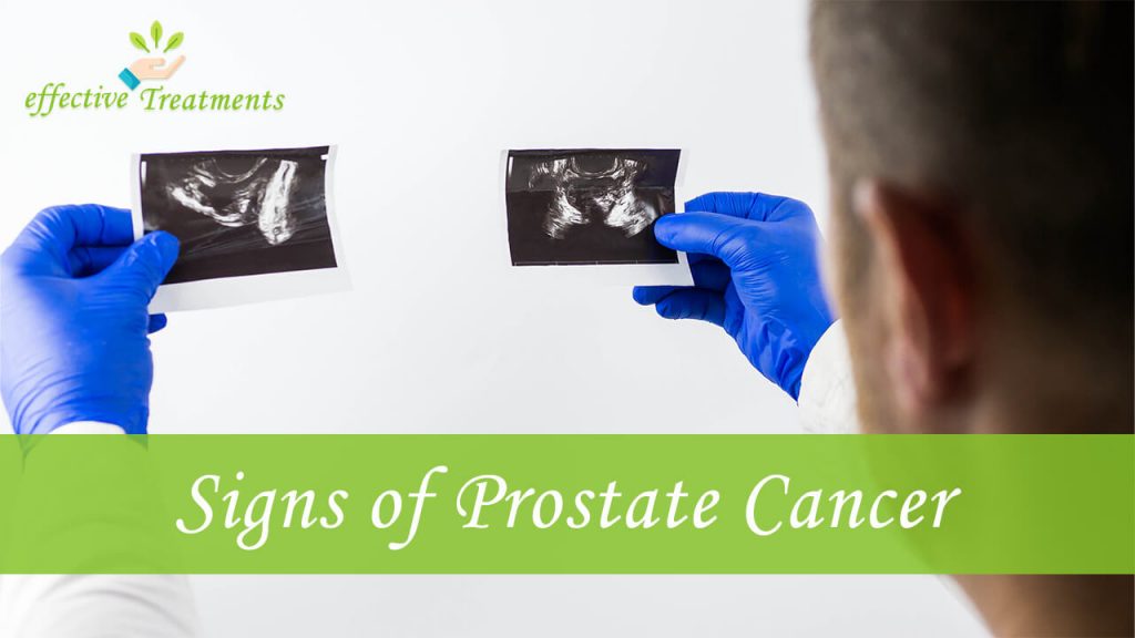 Signs of prostate cancer