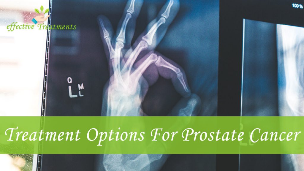 Treatment options for prostate cancer