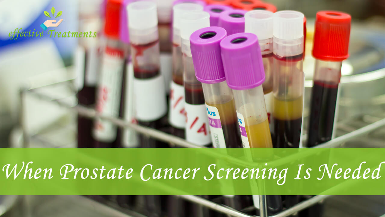 Prostate Cancer Screenings [The Ultimate PSA Guide]