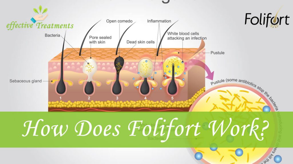 How does Folifort work?