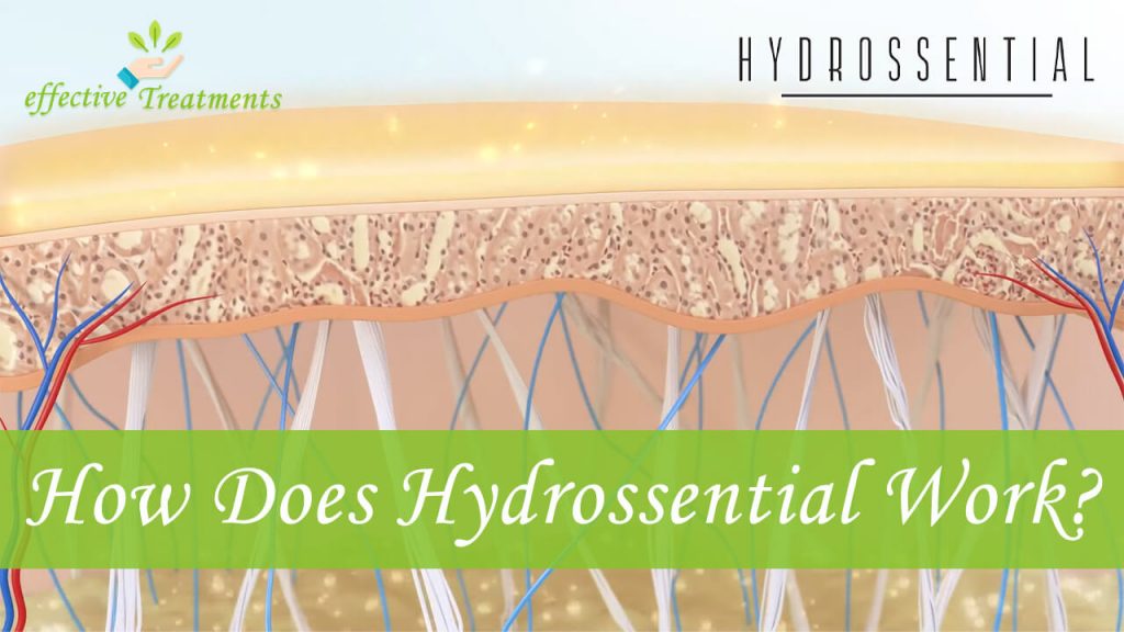 How Does Hydrossential Work