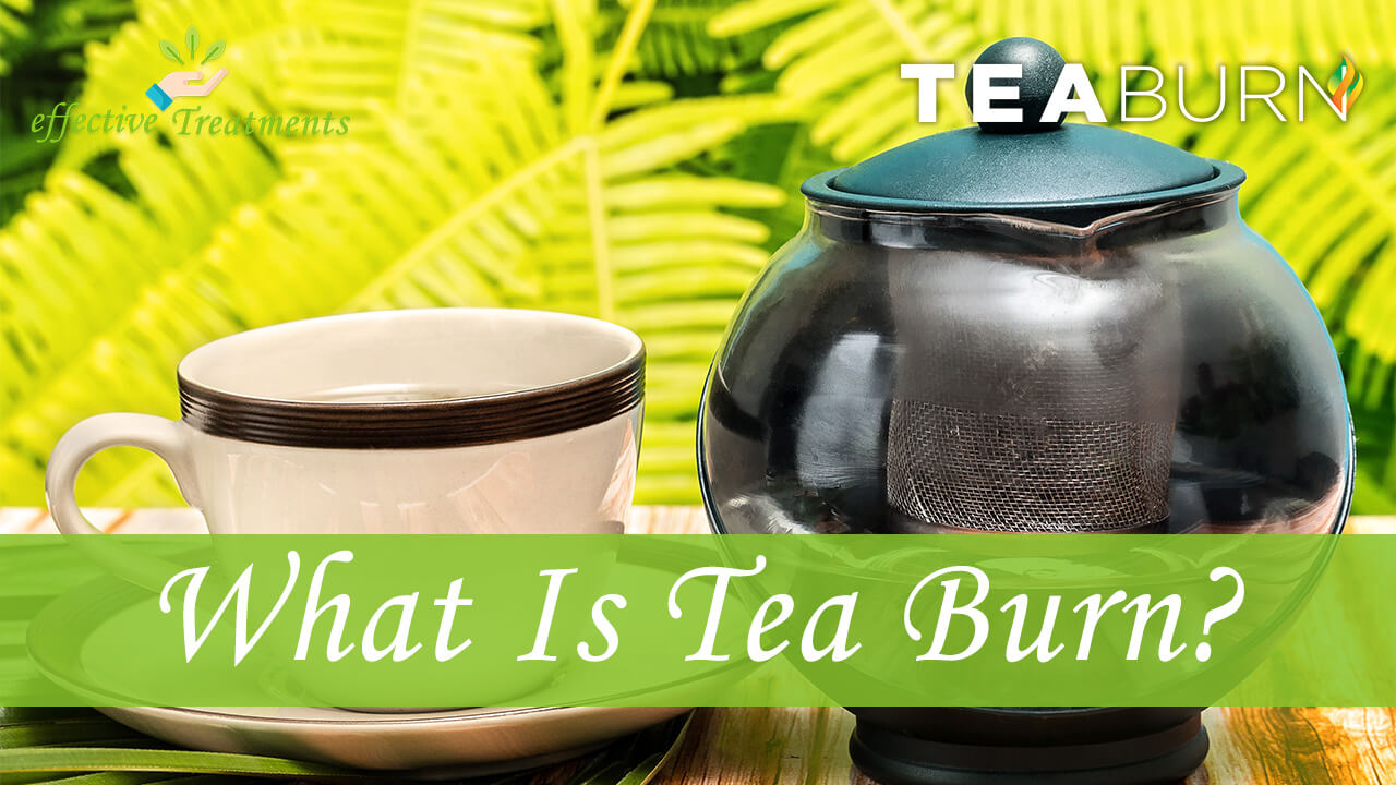 Tea Burn Reviews [John Barban Weight Loss Truth Revealed]