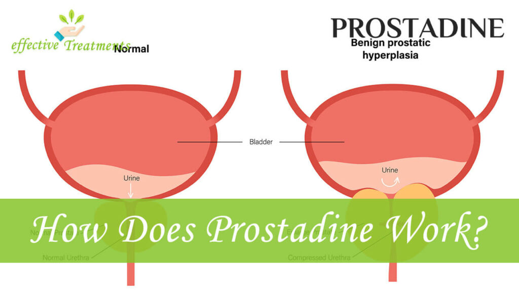 How Does Prostadine Work