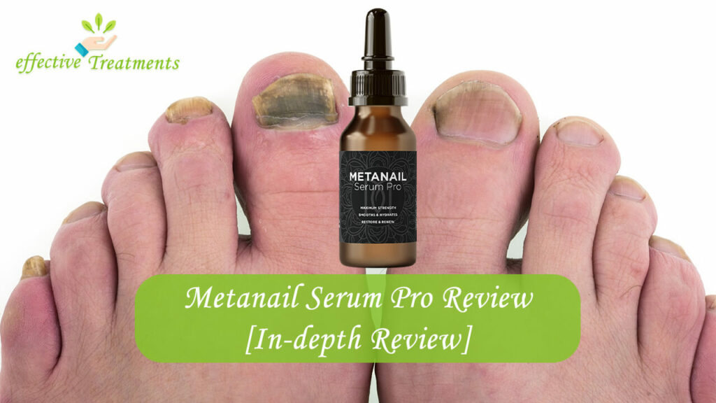 Metanail Serum Pro Review Michael Forrester – The Truth