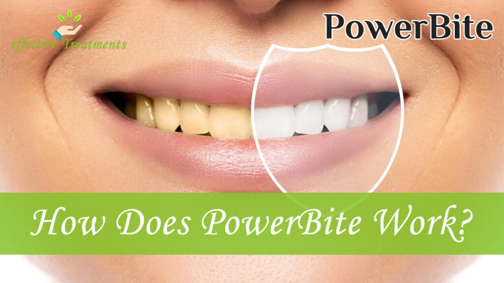 How Does PowerBite Work