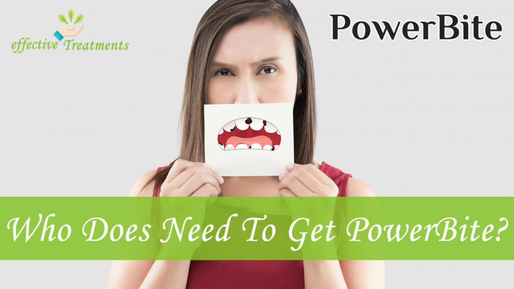 Who Does Need To Get PowerBite