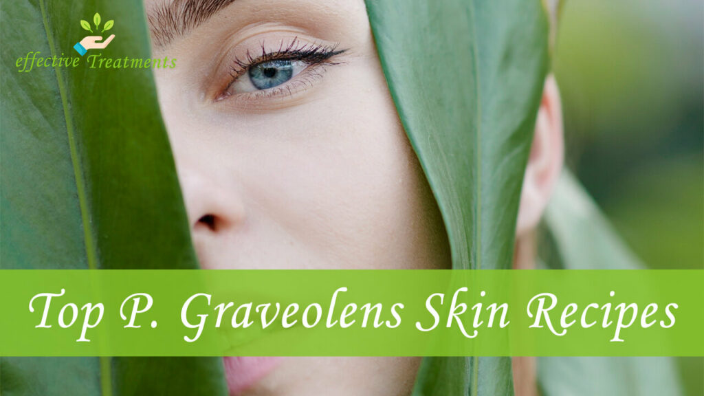 Top 3 Pelargonium Graveolens Recipes for Skin