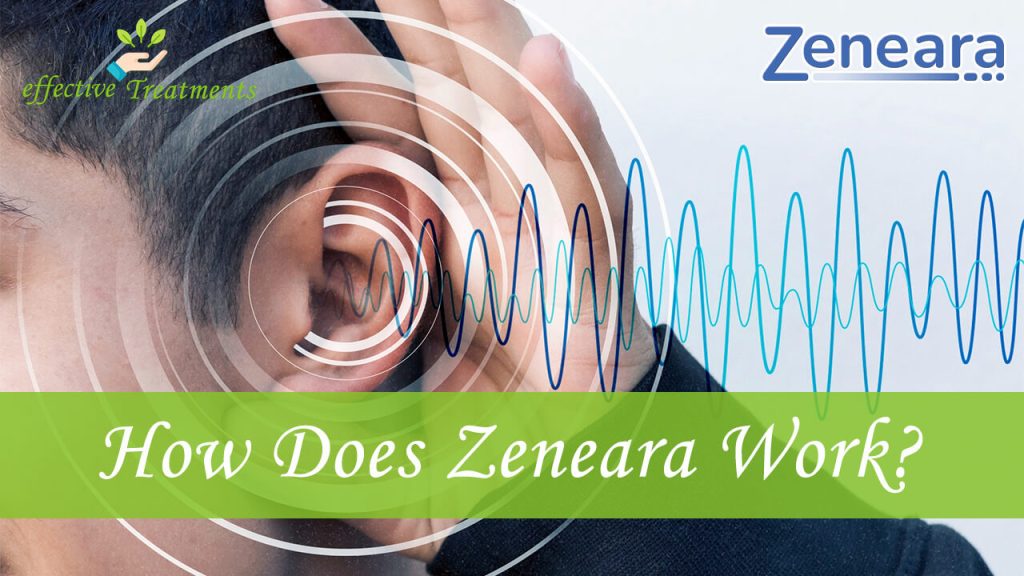 How Does Zeneara Work