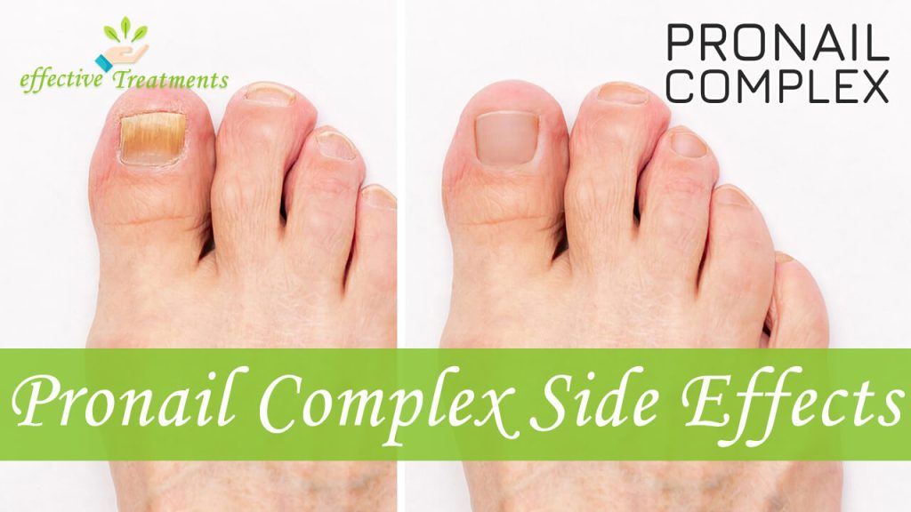 Pronail Complex Side Effects