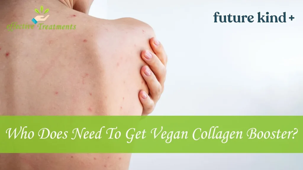 Who Does Need To Get Vegan Collagen Booster Supplement